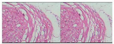 The role of bacterial genital infections in spontaneous preterm delivery: a case-control study